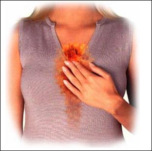 Heartburn With These Easy Tips